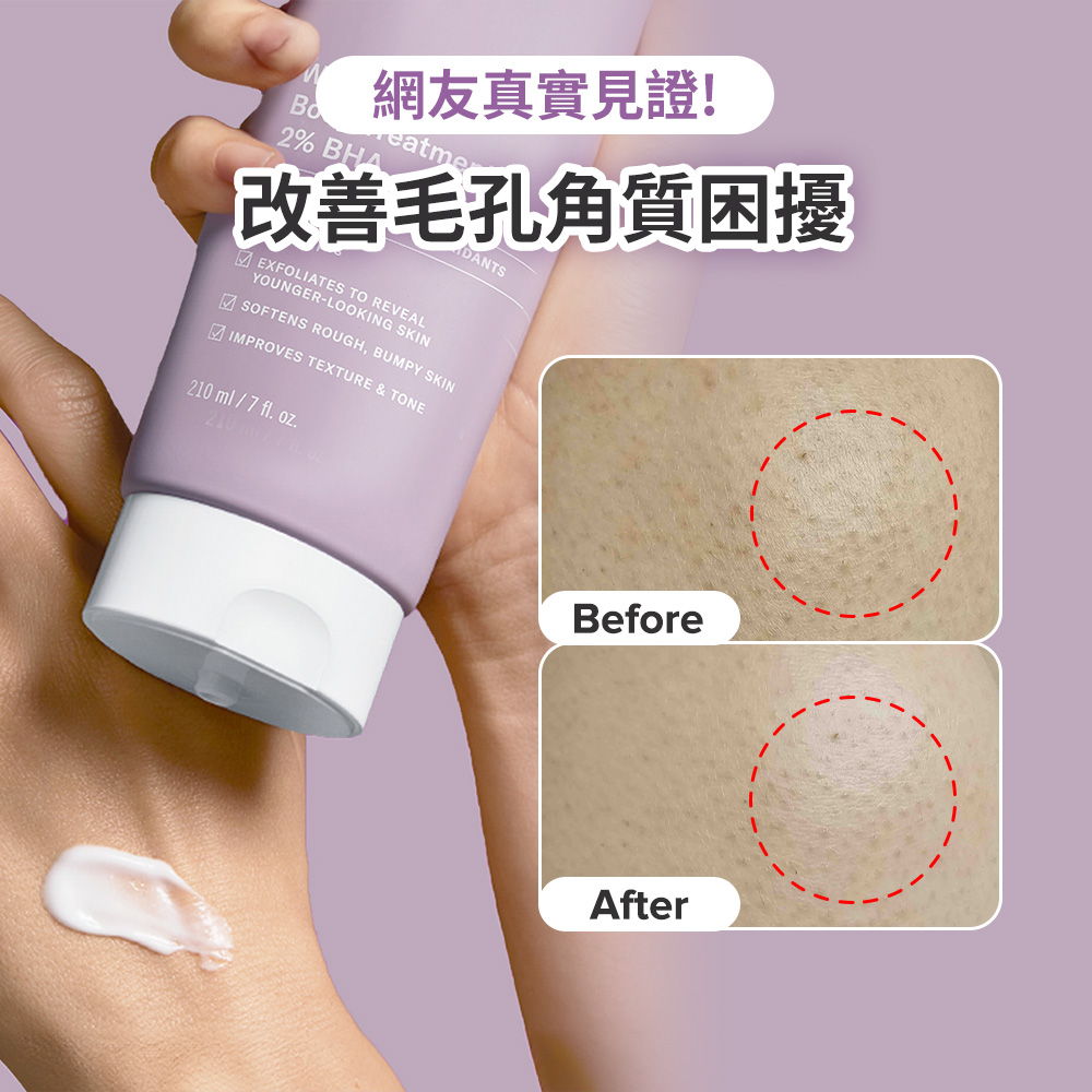 2%水楊酸身體乳 | 寶拉珍選