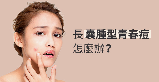 長囊腫型痘痘怎麼辦? 囊腫型痘痘的成因和深層痘的治療方式​