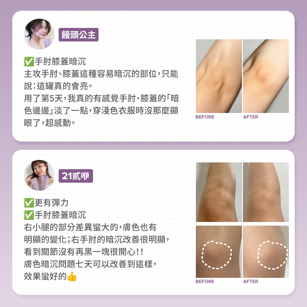 手肘膝蓋暗沉 夠有彈力