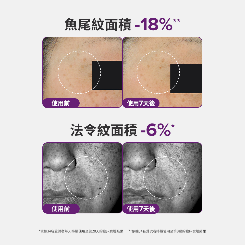 魚尾紋面積-18％** 法令紋面積-6％*