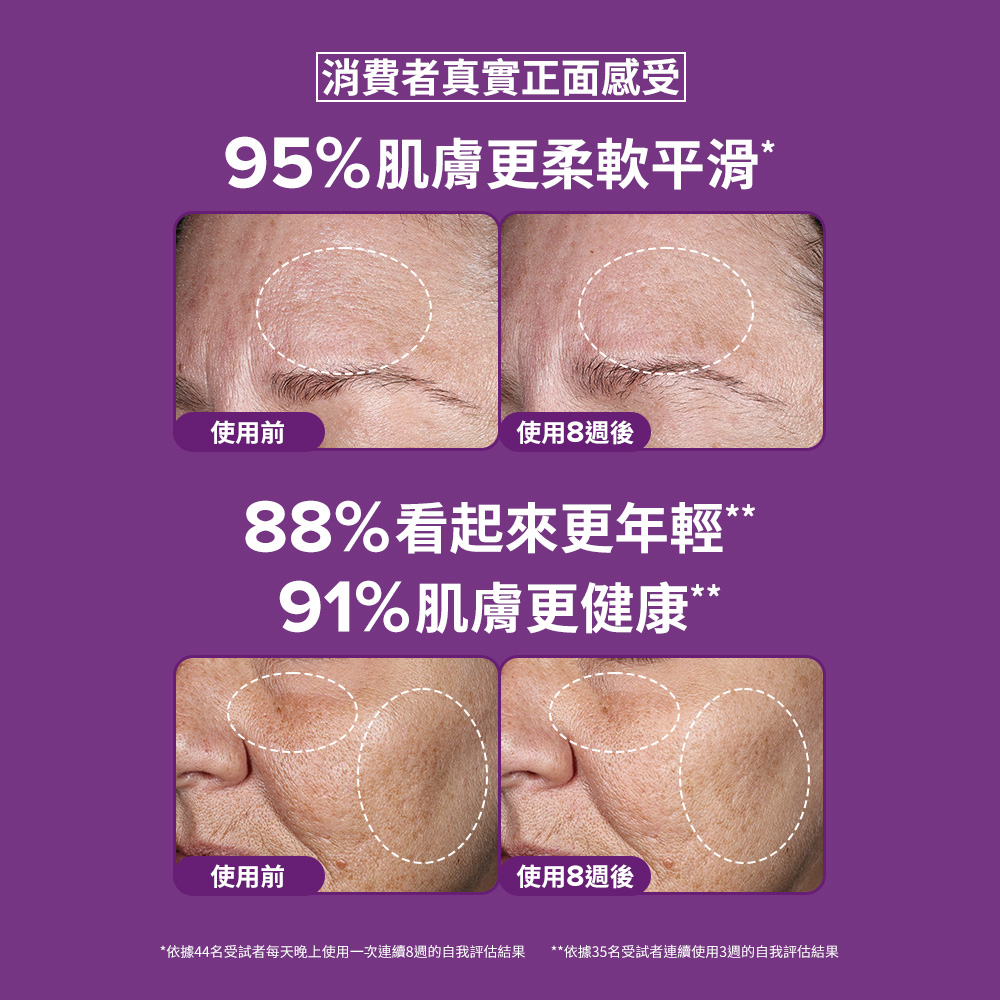 消費者真實正面感受 95％肌膚更柔軟平滑* 88%看起來更年輕“ 91%肌膚更健康“