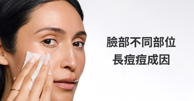 臉部不同部位長痘痘成因