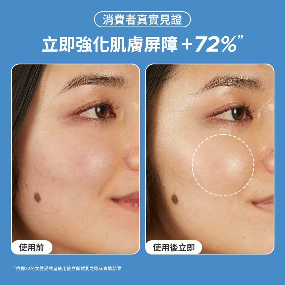 立即強化肌膚屏障+72%