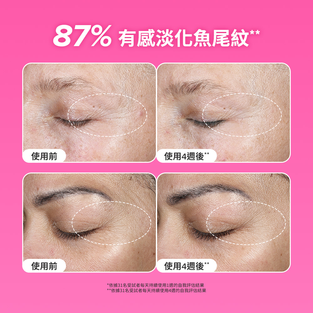 有感淡化魚尾紋