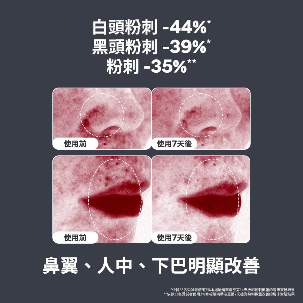 寶拉