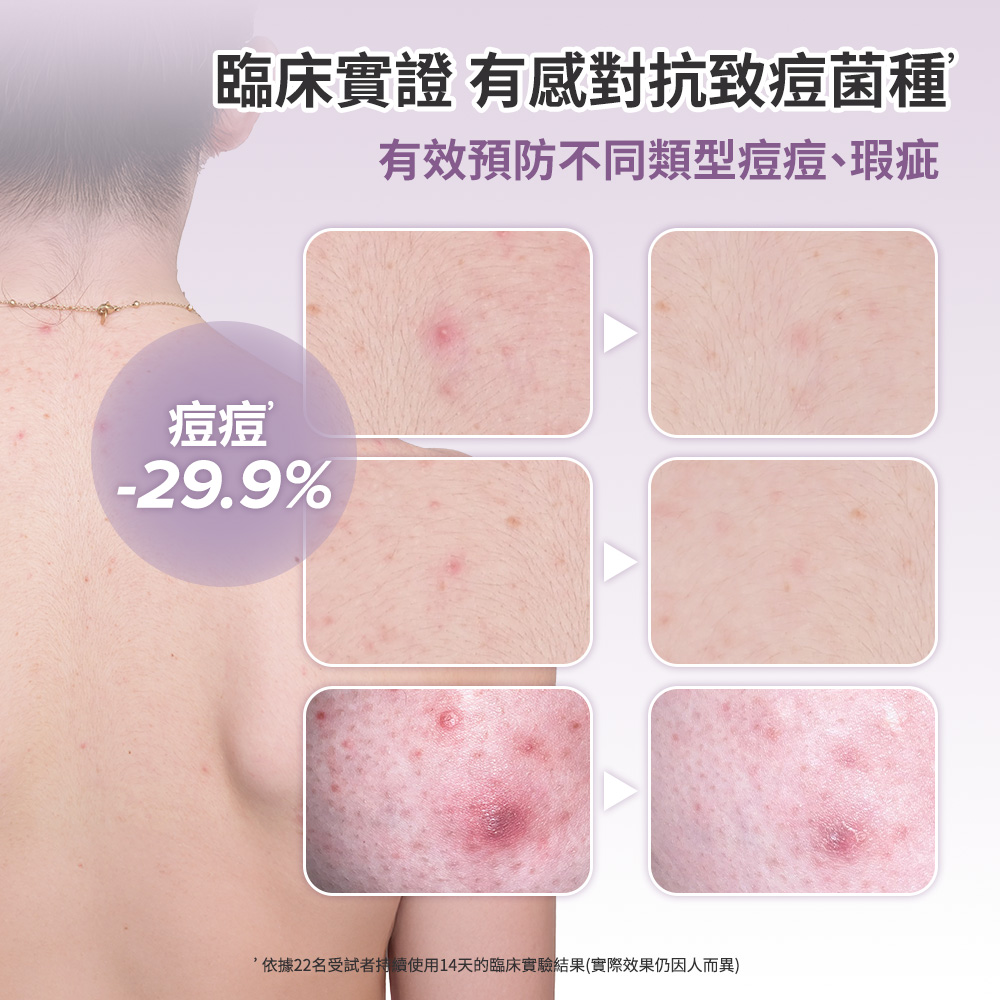 2%水楊酸身體乳 | 寶拉珍選