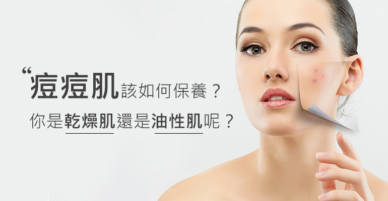 痘肌保養方法有哪些？抗痘五步驟，保養品助攻更輕鬆。你是乾燥肌還是油性肌呢?
