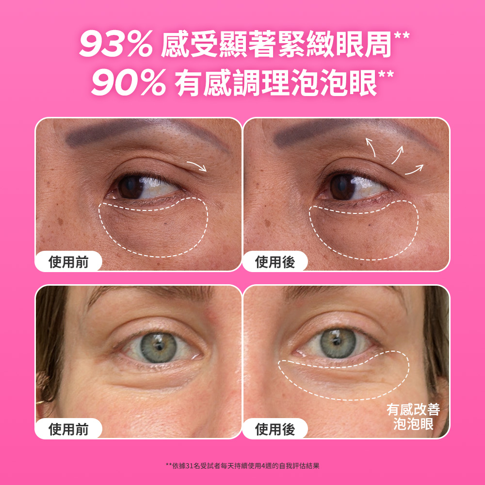 顯著緊緻眼周調理泡泡眼