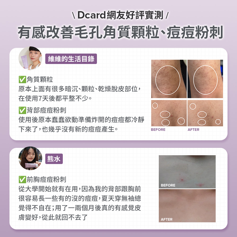 2%水楊酸身體乳 | 寶拉珍選