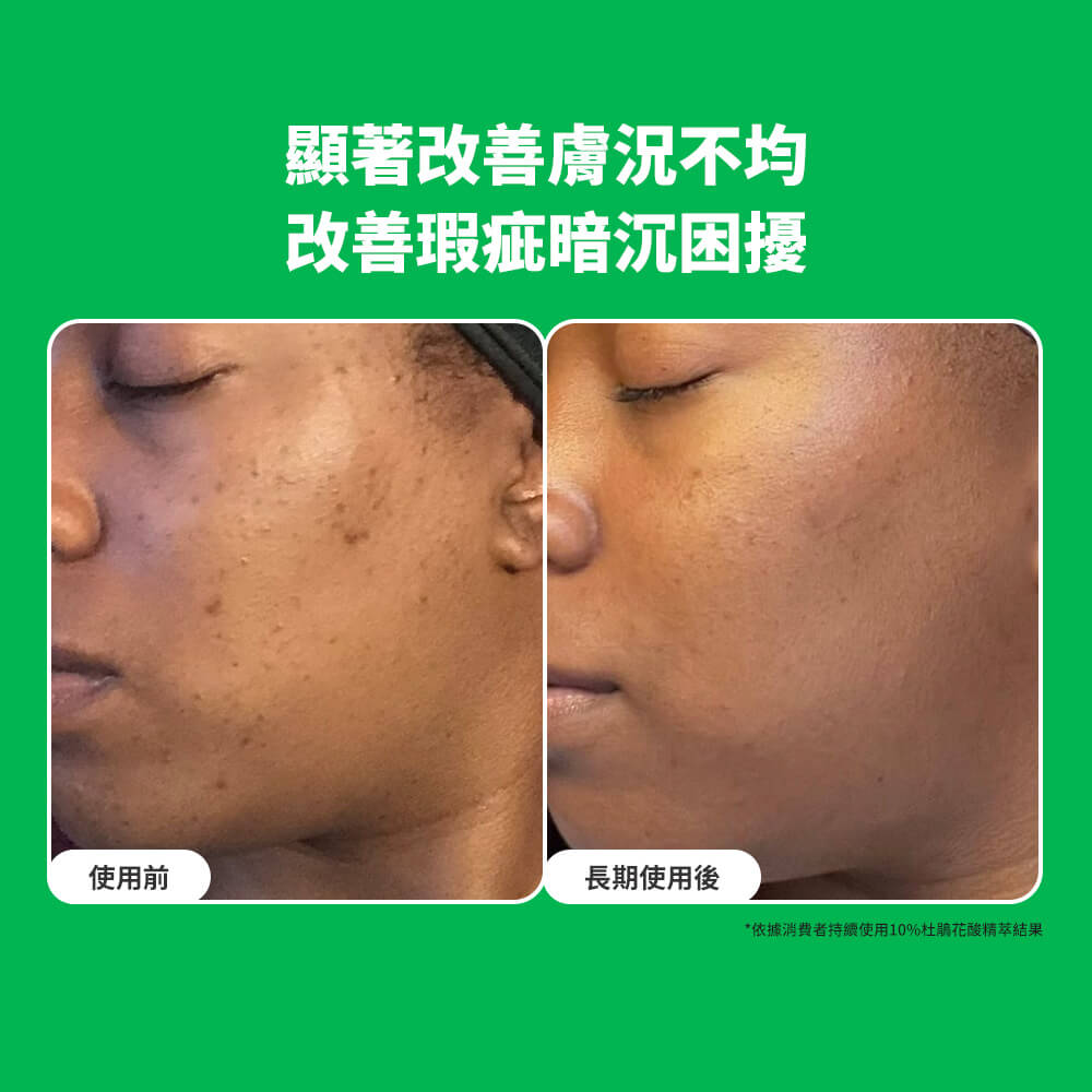 寶拉