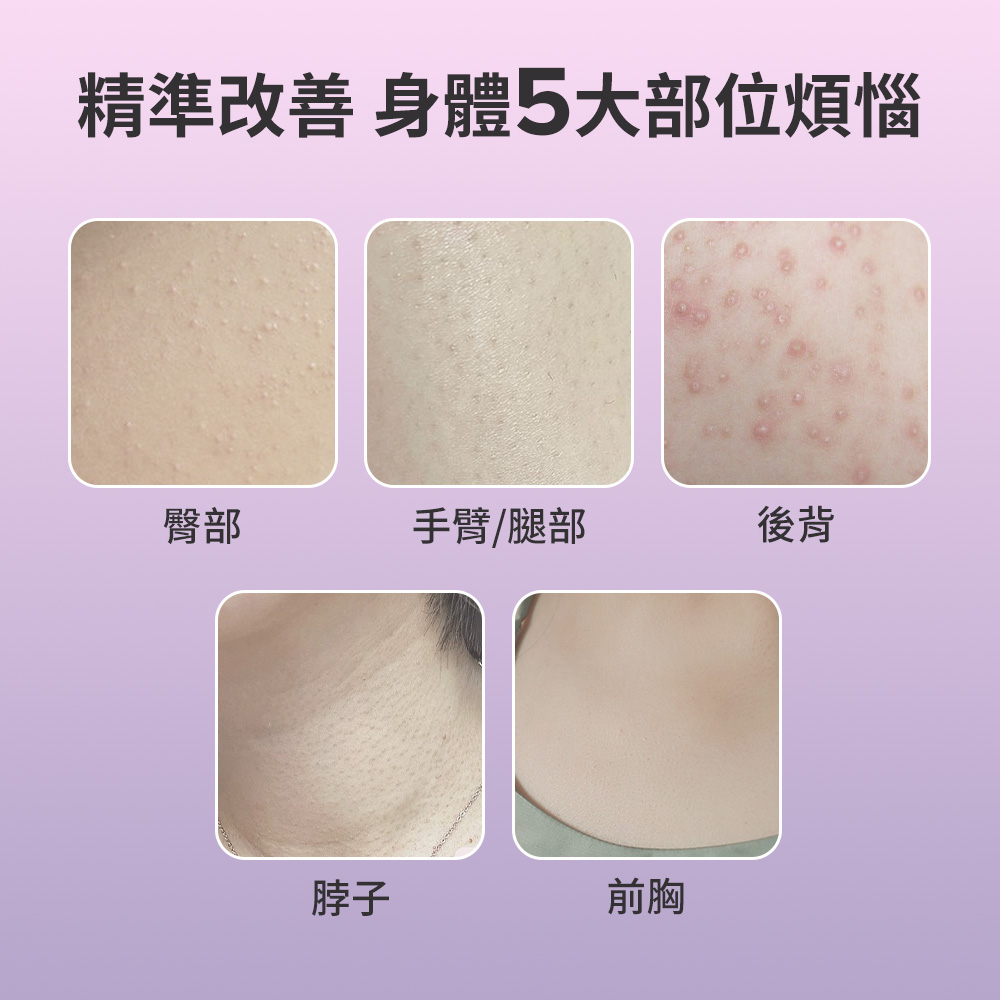 2%水楊酸身體乳 | 寶拉珍選