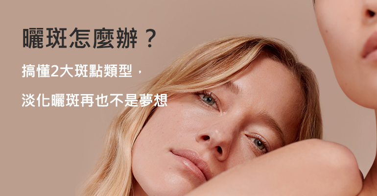 曬斑怎麼辦？搞懂2大斑點類型，淡化曬斑再也不是夢想