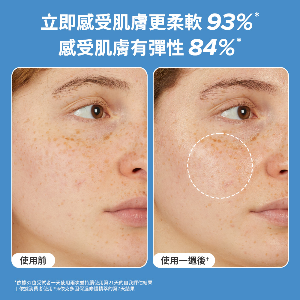 立即感受肌膚更柔軟93% 感受肌膚有彈性84%