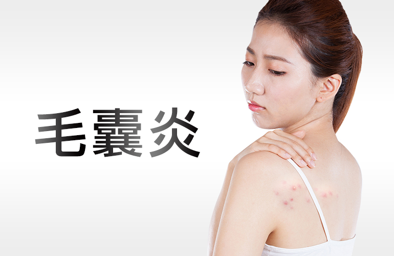 毛囊炎是什麼？會自己痊愈嗎？如何治療與保養？