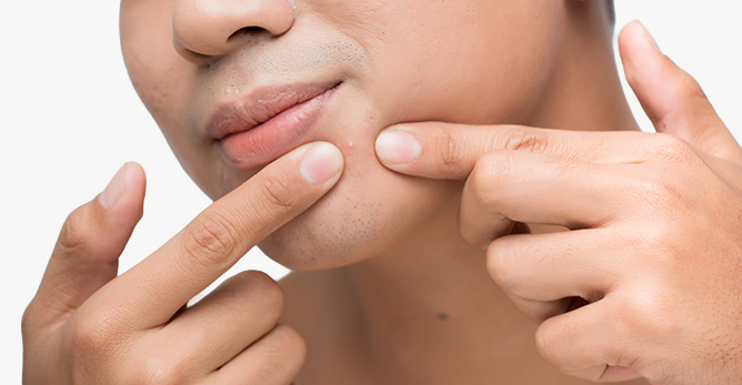 皮脂管絲 vs 黑頭粉刺   兩者差異與清除的方法