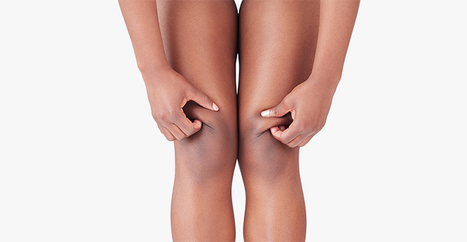 乾性肌膚該如何保養？