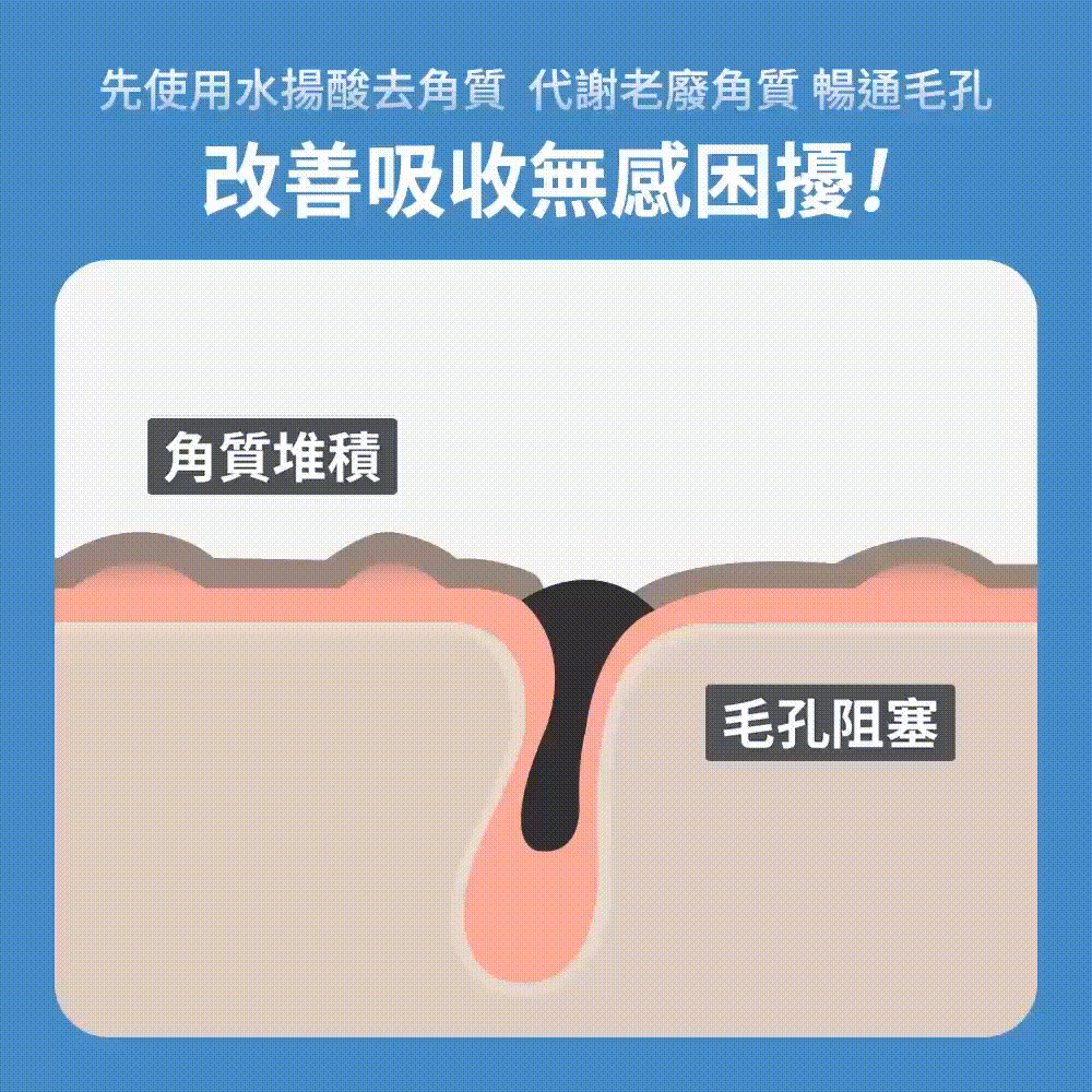 先使用水楊酸去角質 代謝老廢角質 暢通毛孔，改善吸收無感困擾!