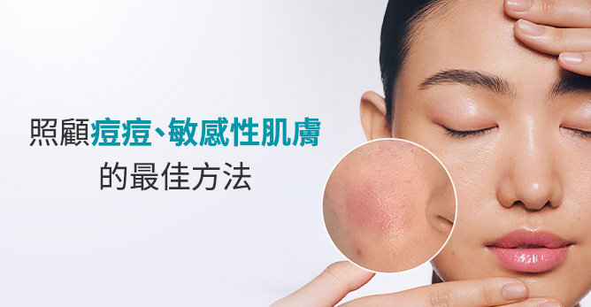 照顧痘痘、敏感性肌膚的最佳方法