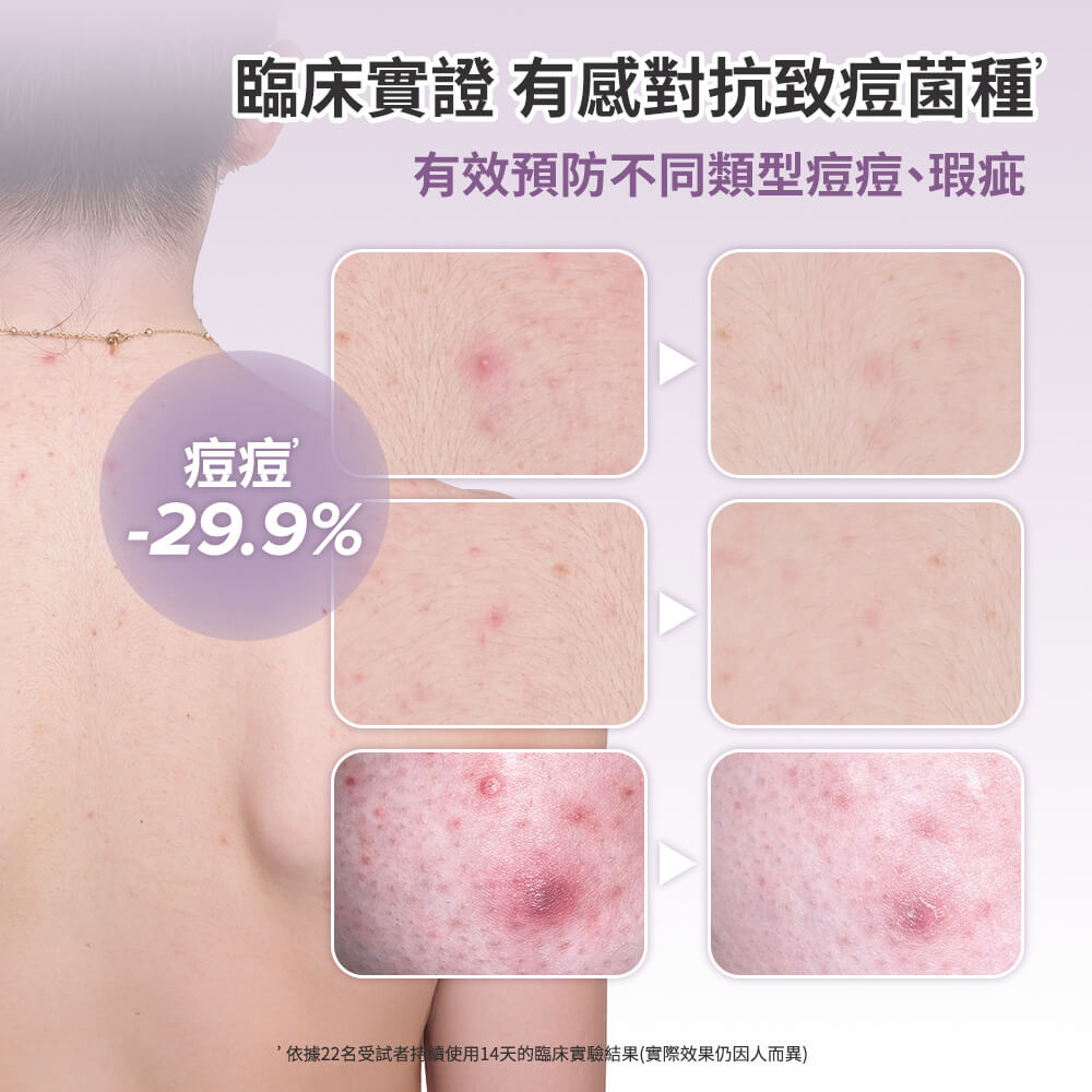 寶拉