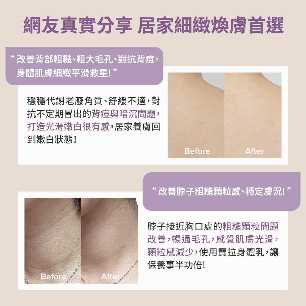 寶拉珍選 2%水楊酸身體乳