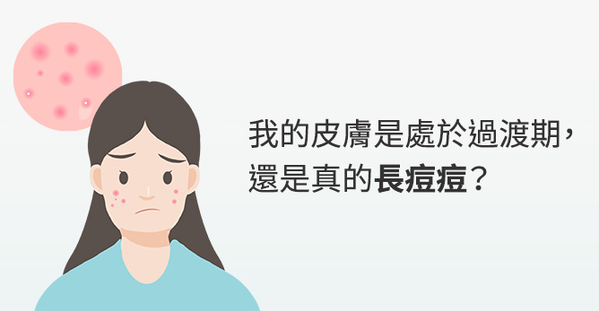 我的皮膚是處於過渡期，還是真的長痘痘？