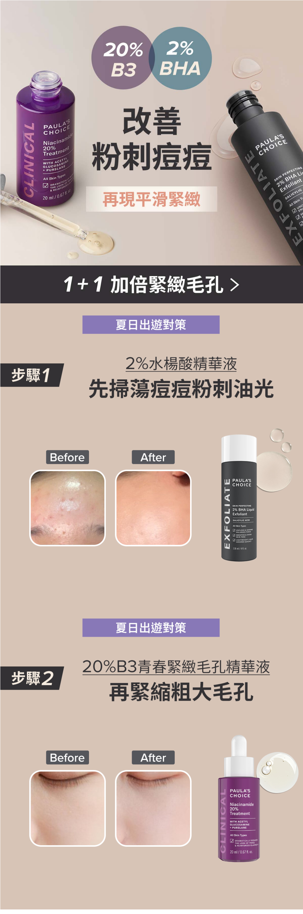 ➤2%水楊酸精華液
寶拉珍選熱銷NO.1全球刷酸始祖-免水洗去角質前導精華，專為粉刺痘痘及毛孔困擾設計，蘊含最高濃度2%水楊酸，在家就能做到居家煥膚！
通過肌膚敏感性測試，全膚質適用，能溫和代謝老
