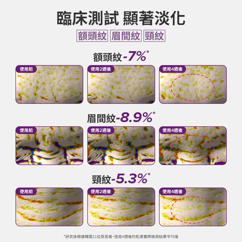 臨床測試顯著淡化 額頭紋 眉間紋 頸紋 額頭紋-7%* 眉間紋-8.9％* 頸紋-5.3％*