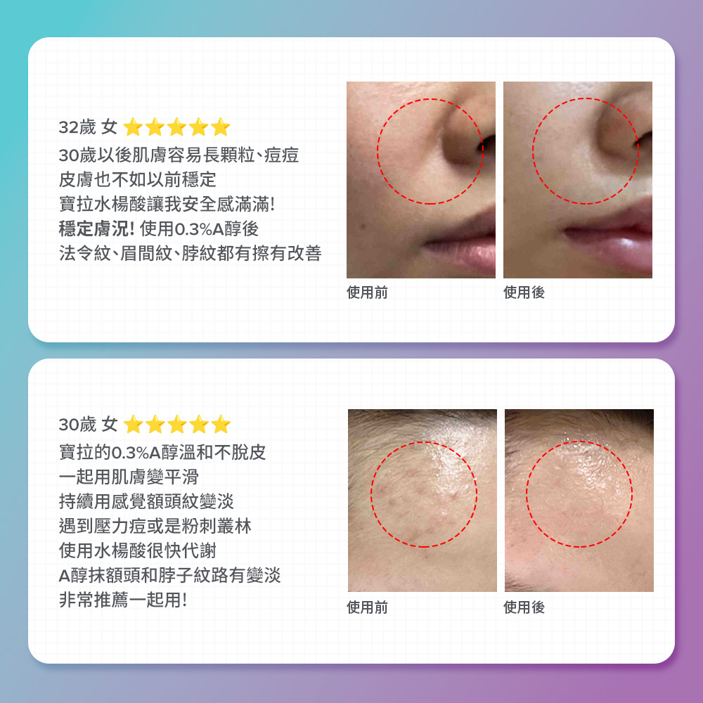 \消費者真實回饋/ 水楊酸＋維他命A 有感抗痘撫