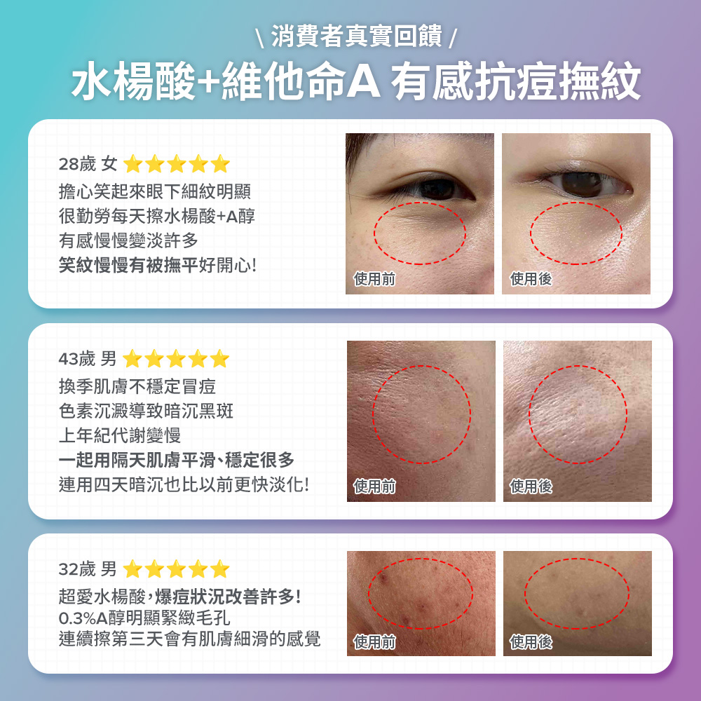 \消費者真實回饋/ 水楊酸＋維他命A 有感抗痘撫