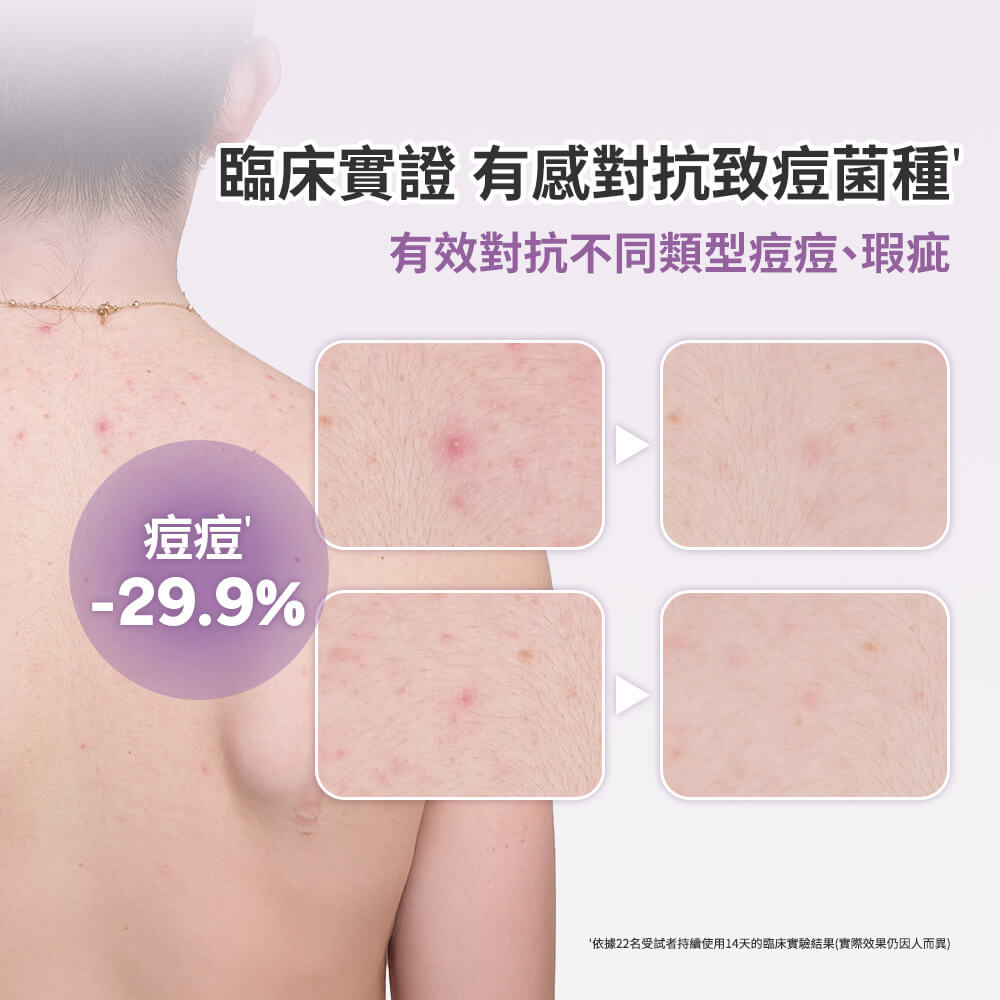 寶拉