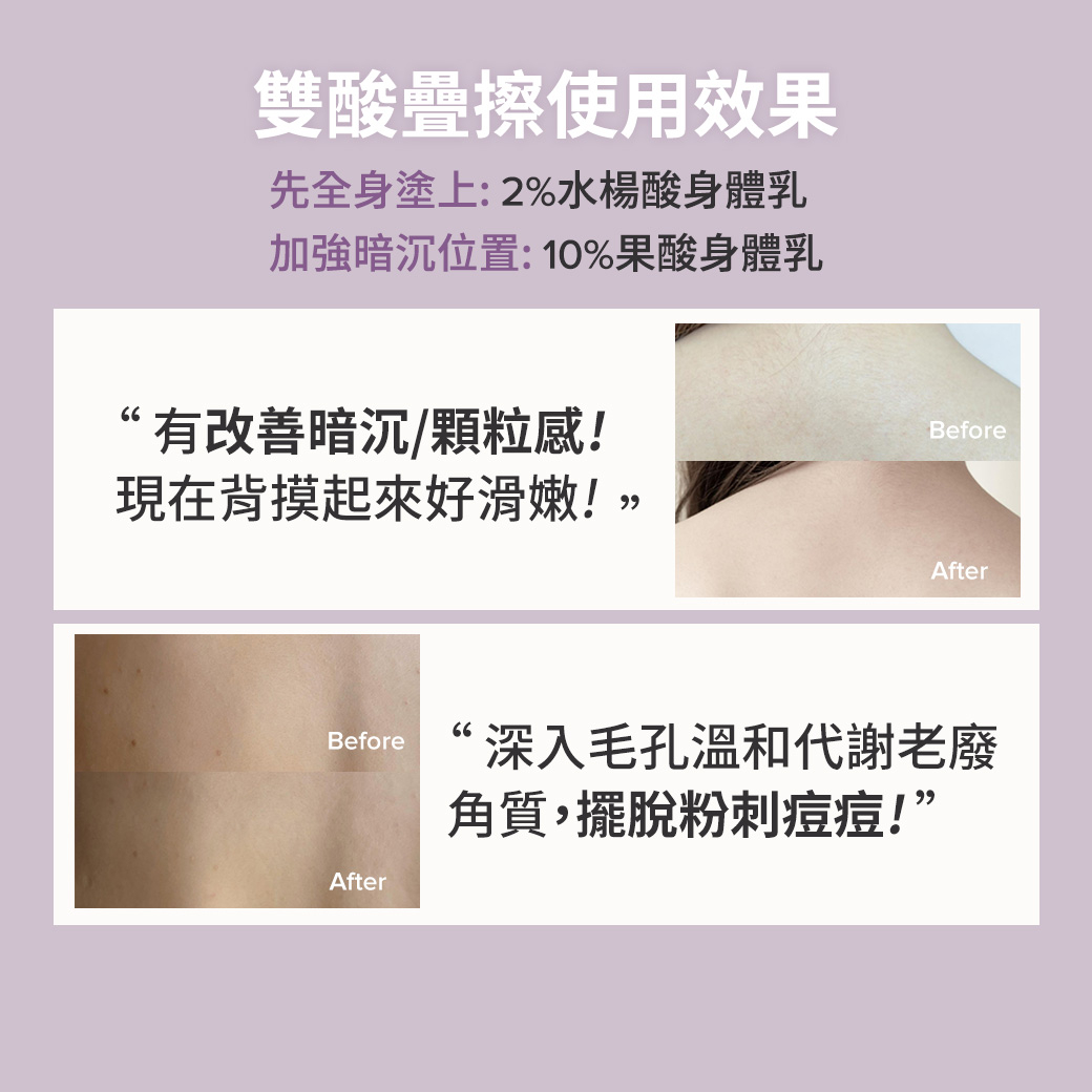 寶拉珍選2%水楊酸身體乳+10%果酸身體乳