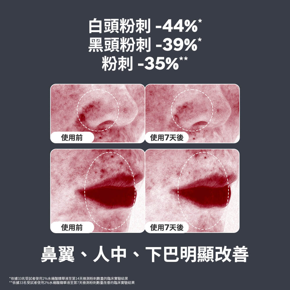 寶拉
